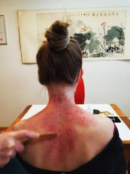 Gua Sha